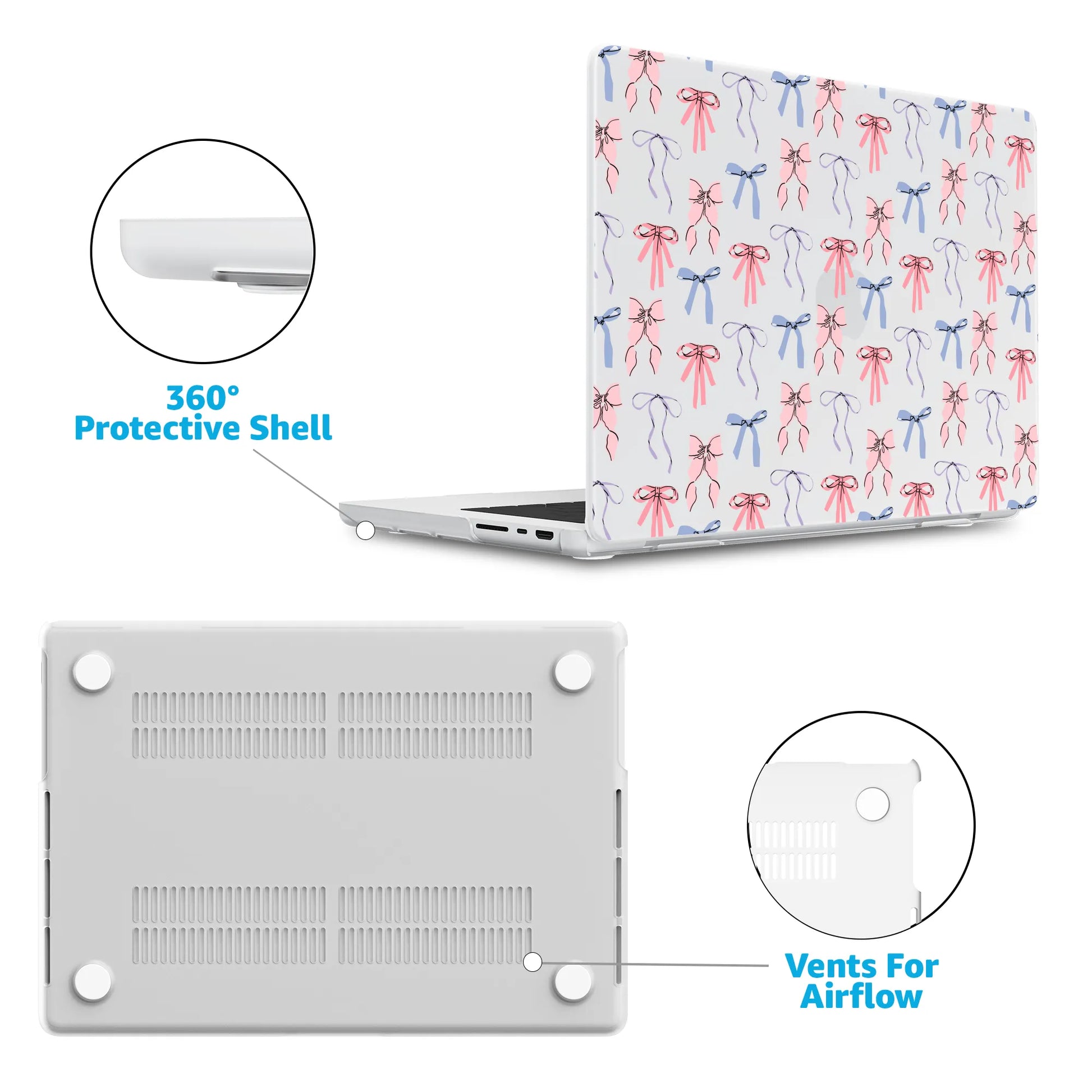 Coquette Girlie | Pastel Bows Laptop Shell