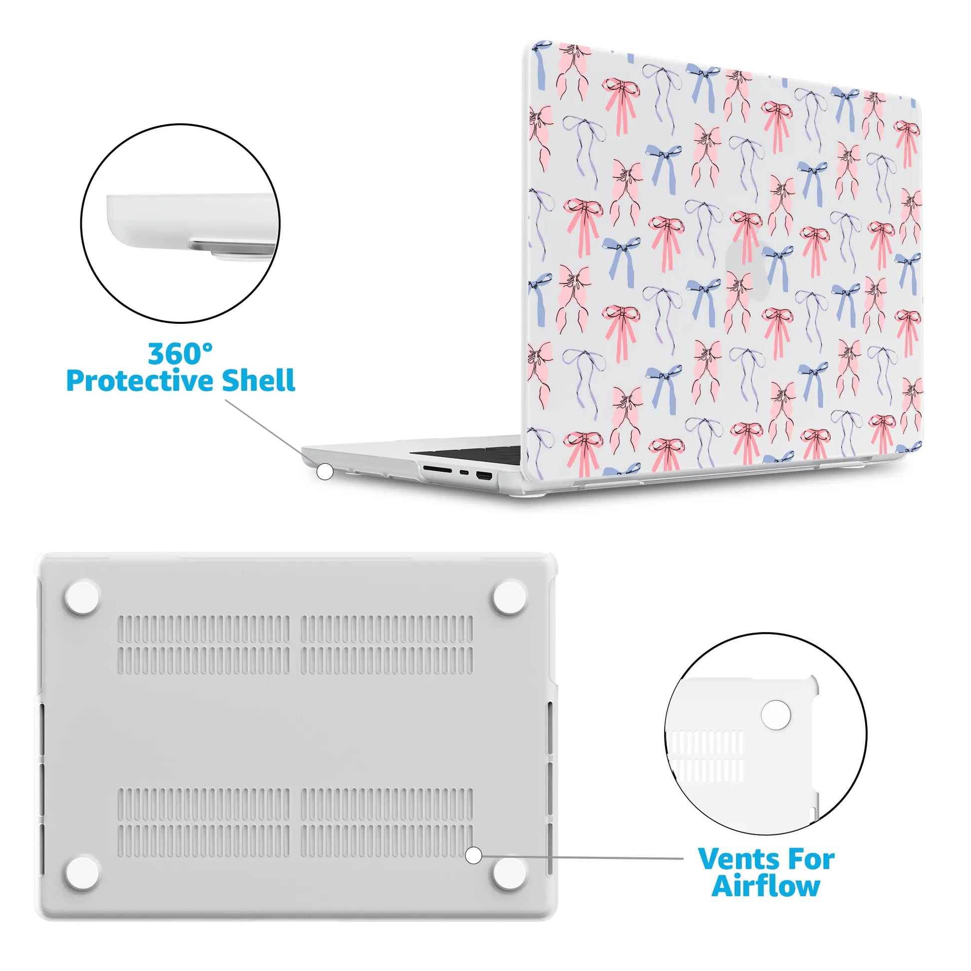 Coquette Girlie | Pastel Bows Laptop Shell