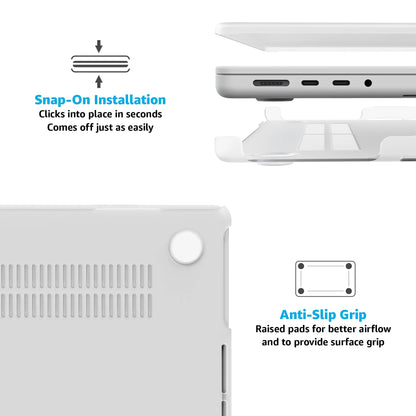 Cherry on Top | Red Cherries Laptop Shell