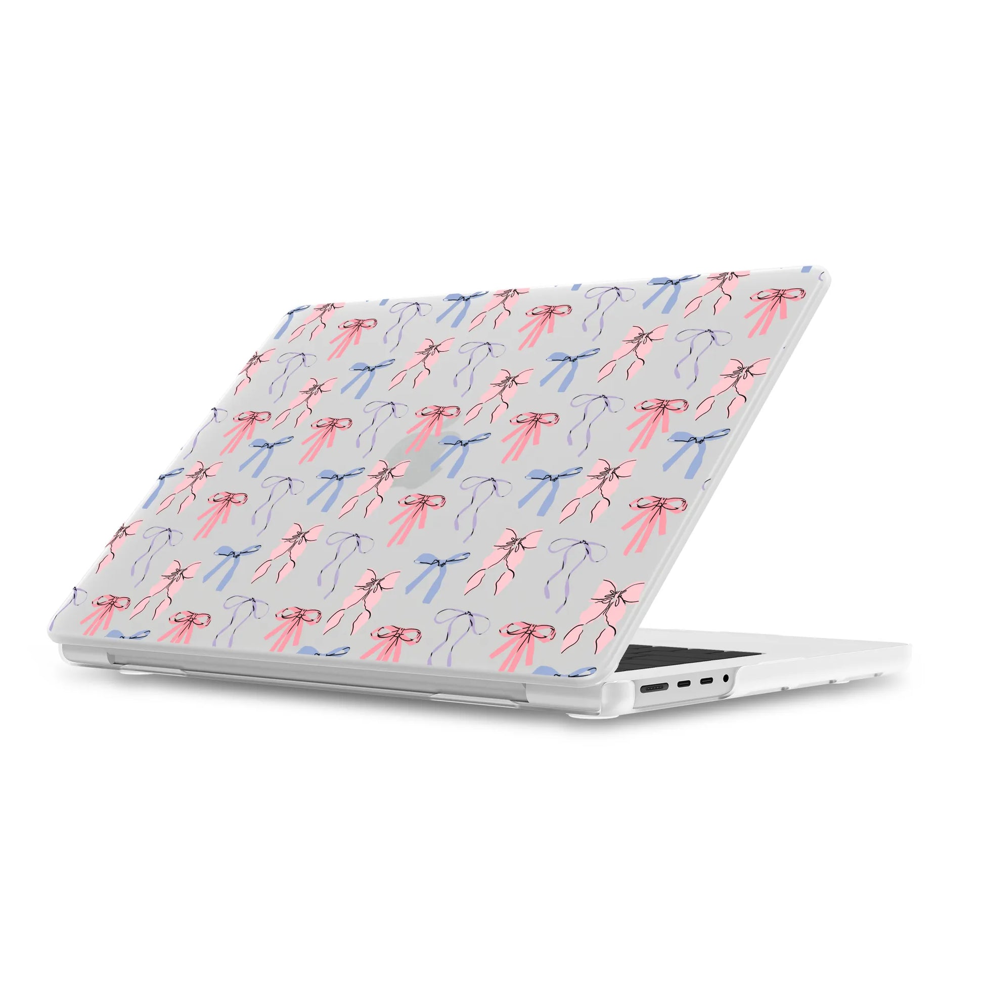 Coquette Girlie | Pastel Bows Laptop Shell